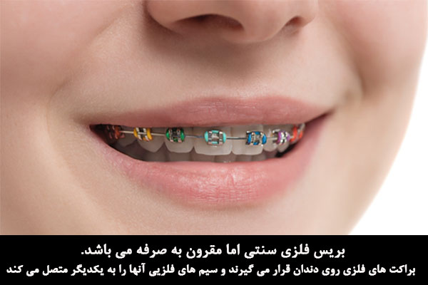 انواع ابزارهای متخصص ارتودنسی
