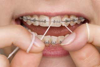 نکات کاربردی مراقبت های ارتودنسی