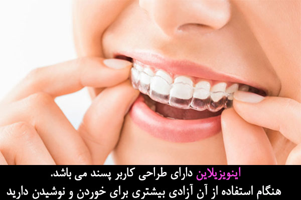 ترازکننده اینویزیلاین در ارتودنسی