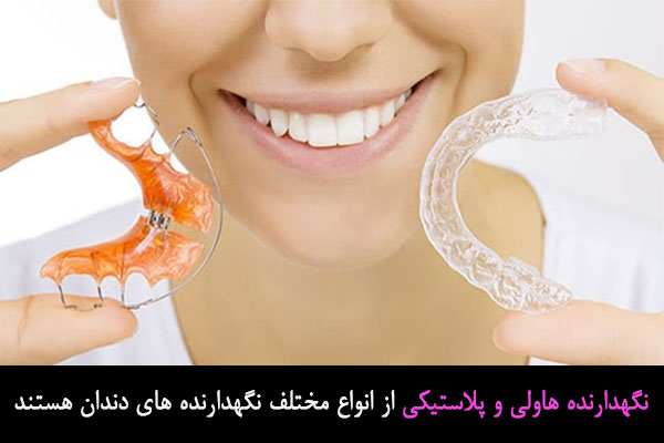 انواع مختلف نگهدارنده های دندان