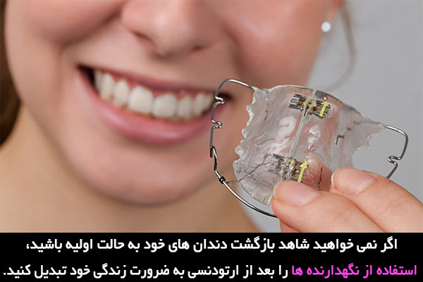استفاده از نگهدارنده ها بعد از ارتودنسی