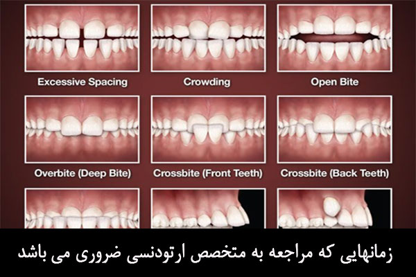 زمان مراجعه به متخصص ارتودنسی