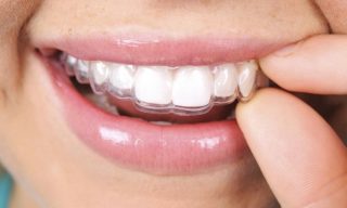 متخصص ارتودنسی اسلامشهر 2