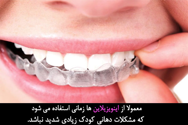 اینویزیلاین ها در درمان ارتودنسی کودکان