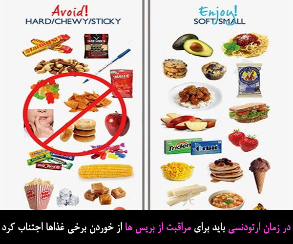 غذای مناسب برای مراقبت پس از ارتودنسی