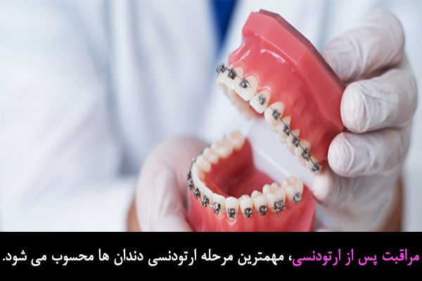 مراقبت پس از ارتودنسی