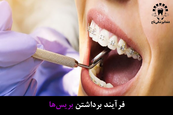ارتودنسی دندان