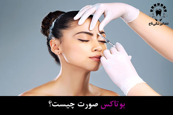 بوتاکس صورت
