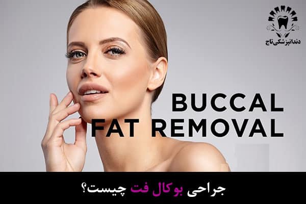 جراحی بوکال فت چیست
