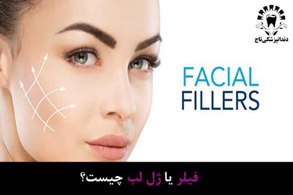 فیلر لب