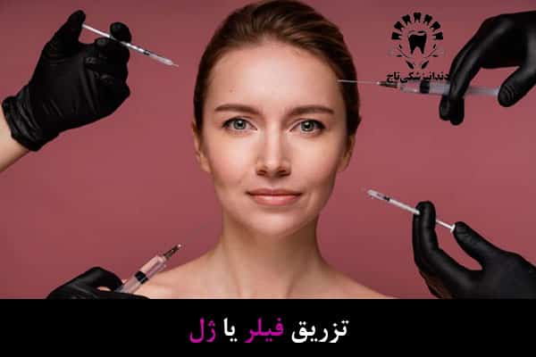 تزریق فیلر