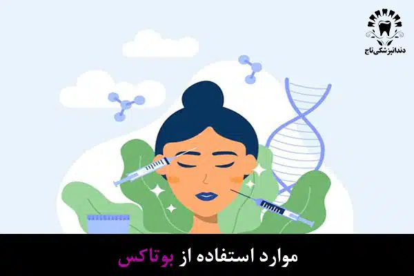 بوتاکس