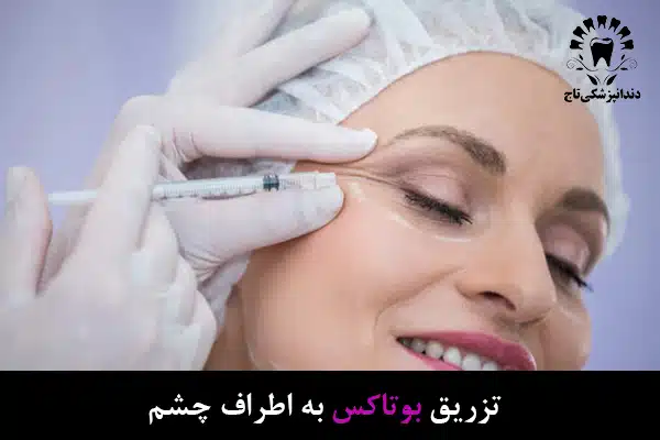 تزریق به اطراف چشم