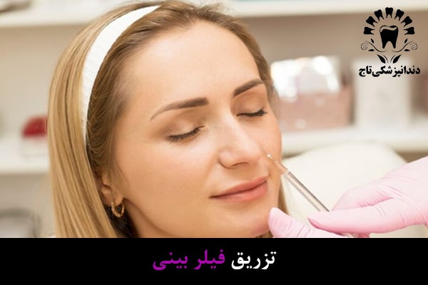 تزریق