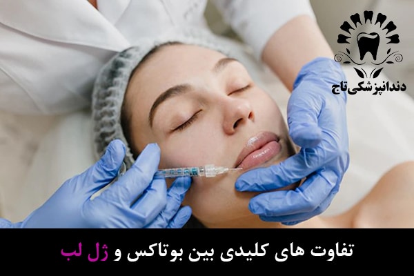 فیلر لب