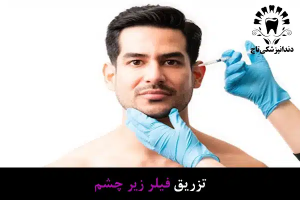 تزریق فیلر زیر چشم