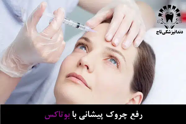 بوتاکس پیشانی