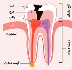 تشخیص و درمان به موقع عفونت دندان کودکان بسیار مهم است. والدین باید به علائم و نشانه ‌ها دقت کرده و در صورت مشاهده هرگونه مشکل، به دندان‌ پزشک مراجعه نمایند.