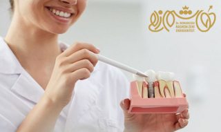 کاشت ایمپلنت در اسلامشهر و واوان، هزینه ها و عوامل موثر