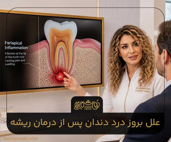 علل بروز درد دندان پس از درمان ریشه