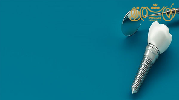 بهترین برندهای ایمپلنت در ایران؛ اشترومن، آستم و دیو ...