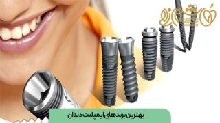 بهترین مارک‌ های ایمپلنت در ایران