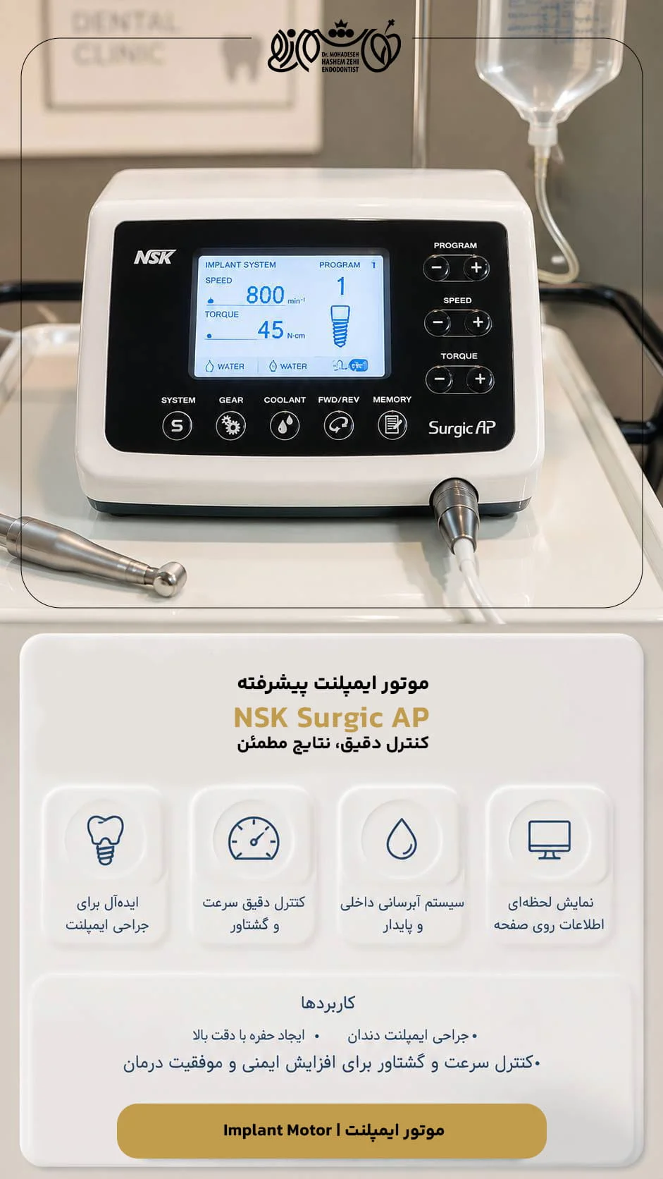 موتور-ایمپلنت